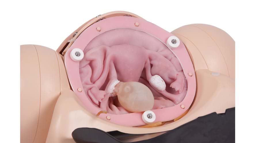 Uterus of the Surgical Female Pelvic Trainer (SFPT) Mk 2 in Light Skin Tone