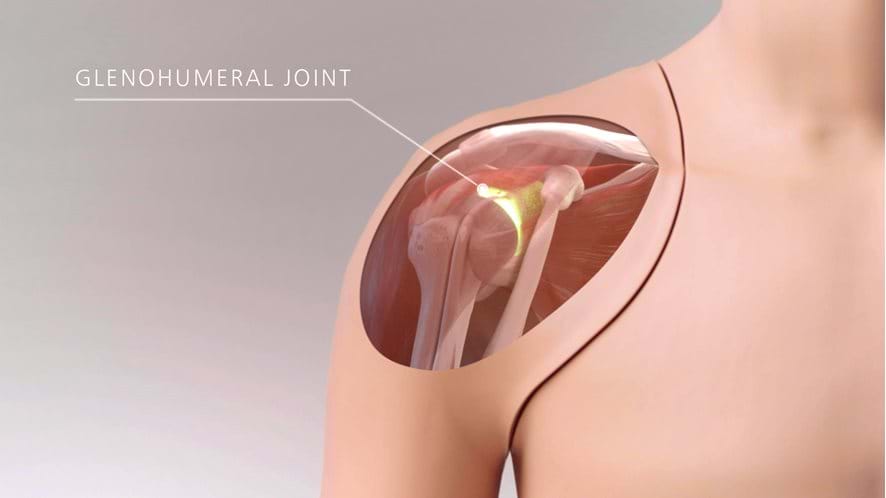 Glenohumeral joint of the Ultrasound guided Shoulder Injection Trainer in Light Skin Tone