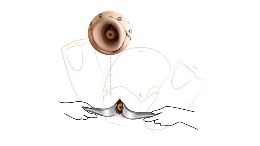 Diagram of the Cervical Cerclage Module PROMPT Flex Light Skin Tone