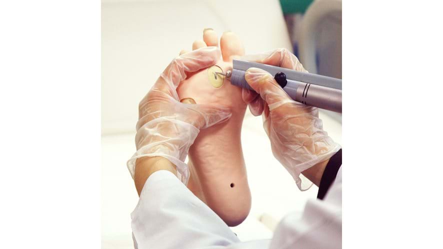 Callosities removal using the Kyoto Kagaku Medical foot Care Model 