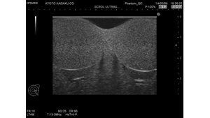 Ultrasound picture using the Koyoto Kagaku Scrotal Ultrasound Phantom 
