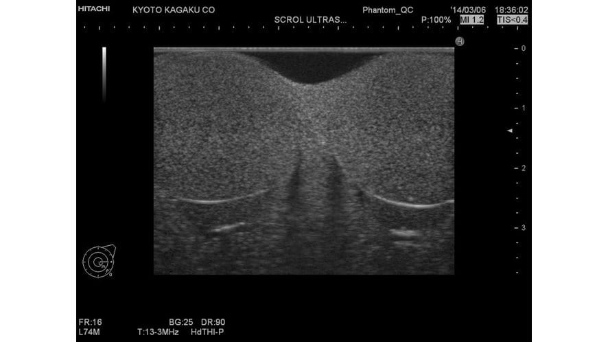 Ultrasound picture using the Koyoto Kagaku Scrotal Ultrasound Phantom 