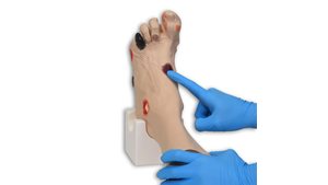 'Wilma' Wound Foot™ with 20 conditions which allow for the identification & staging of wounds 