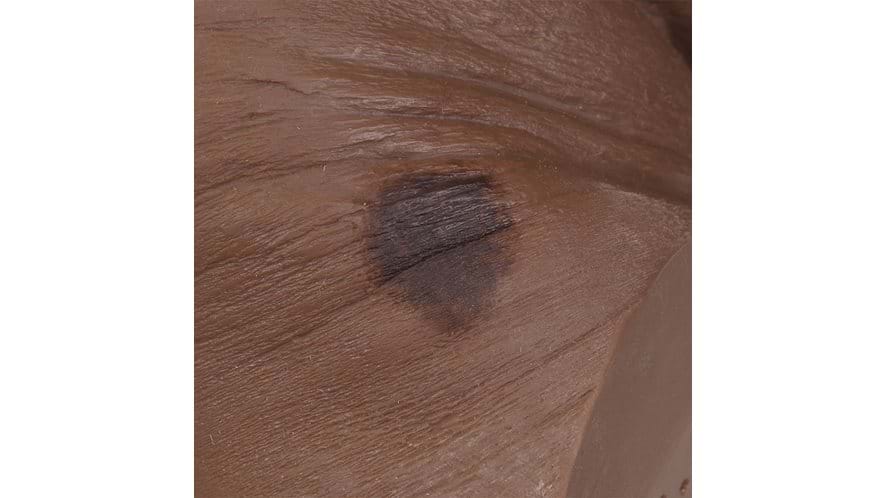 Stage 1 Wound of the Seymour II Wound Care Model In dark skin tone