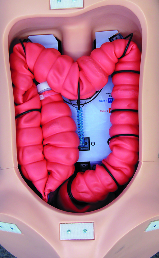 Colonoscopy Training Simulator (Light Skin Tone) | Waldemar Larsson